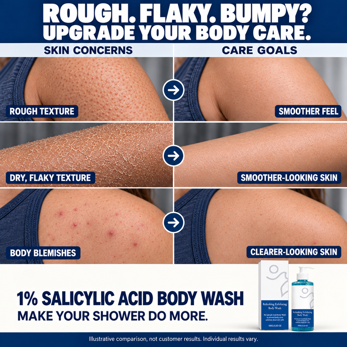 🔥 Flash Sale 🔥 Salicylic Acid Exfoliating Body Wash 🚿 Smoothing for Keratosis Pilaris & Body Acne-8RH7