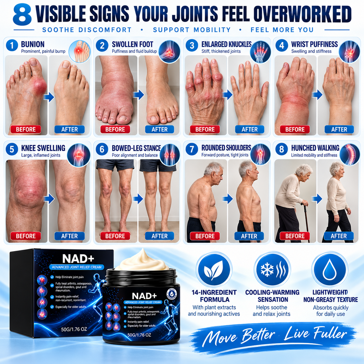 🚨 Stiff Knees? Aching Back? Sore Elbows? Foot & Ankle Pressure? ⚠️ Joint Rescue Advanced Relief Cream-8JX3