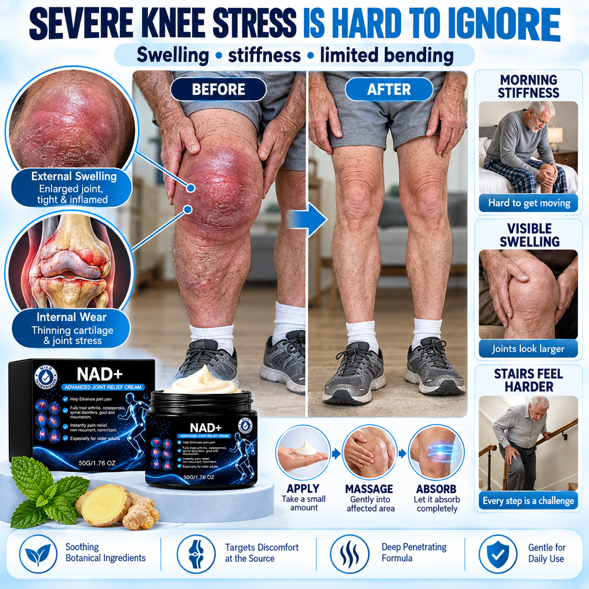 🚨 Stiff Knees? Aching Back? Sore Elbows? Foot & Ankle Pressure? ⚠️ Joint Rescue Advanced Relief Cream-8JX3