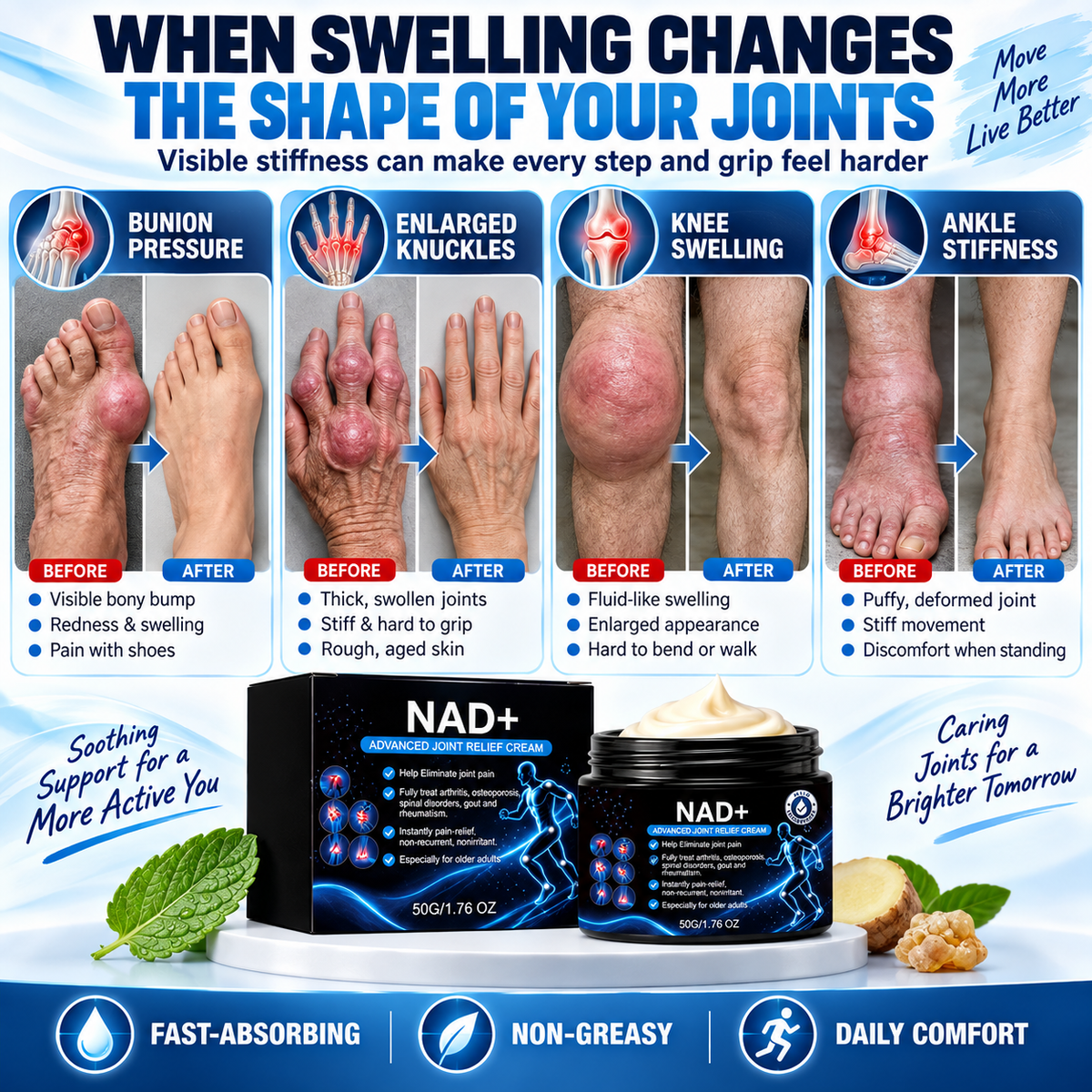 🚨 Stiff Knees? Aching Back? Sore Elbows? Foot & Ankle Pressure? ⚠️ Joint Rescue Advanced Relief Cream-8JX3