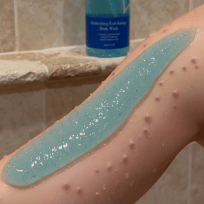 🔥 Flash Sale 🔥 Salicylic Acid Exfoliating Body Wash 🚿 Smoothing for Keratosis Pilaris & Body Acne-8RH7